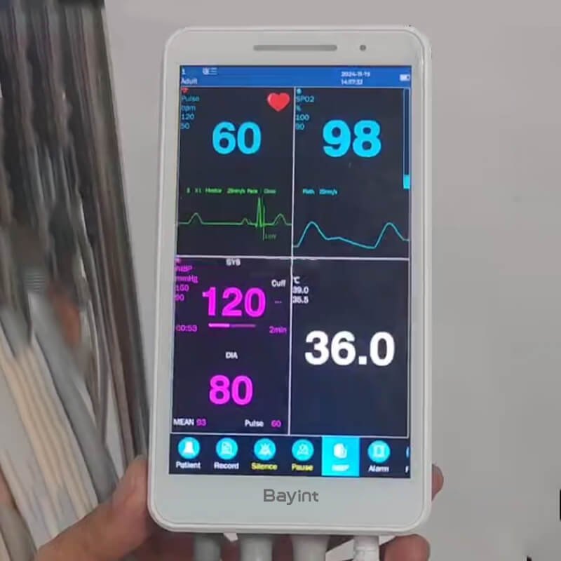 vital sign monitor in hospital